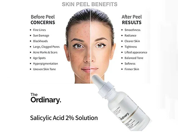 THE ORDINARY Salicylic Acid 2% Solution 30ml - CANADA - 769915193862