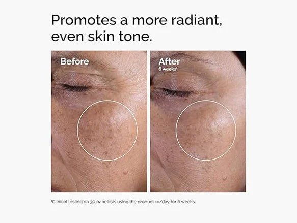 The Ordinary Glycolic Acid 7% Exfoliating Toner Daily AHA Toner to Improve Skin Texture, Tone & Luminosity 240ml