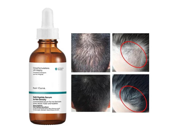 The Ordinary Multi-Peptide Serum For Hair Density 60ml - CANADA